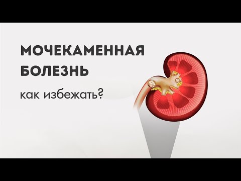 Видео: Профилактика мочекаменной о которой вы не знали