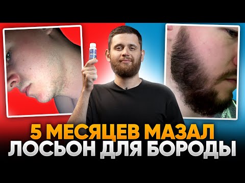 Видео: Результаты ксиноксина для роста бороды в 24 года / Отменил и продолжил курс