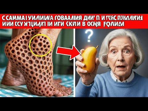 Видео: ПЕНСИОНЕРАМ: Этот 1 фрукт очистит артерии ног и остановит плохое кровообращение