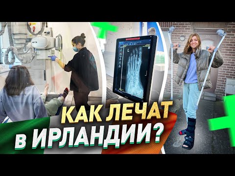 Видео: СЛОМАЛА НОГУ | Медицина в Ирландии | Сколько стоит гипс? жизнь в Ирландии