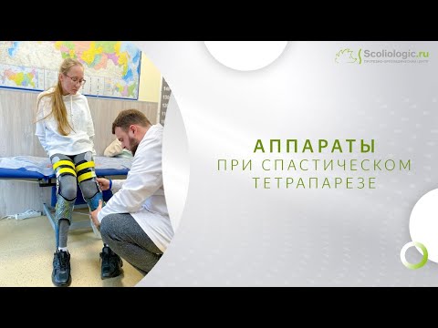 Видео: Аппараты на нижние конечности при спастическом тетрапаразе – безопасная и уверенная ходьба.