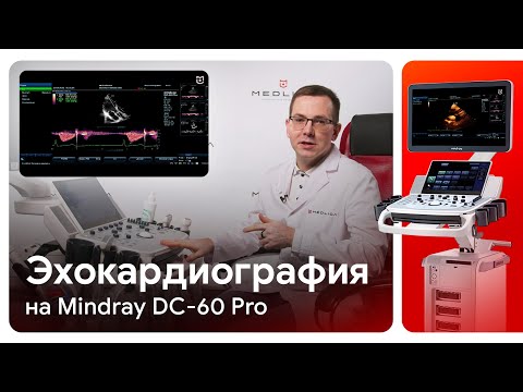 Видео: Эхокардиография (ЭхоКГ) на Mindray DC-60 Pro