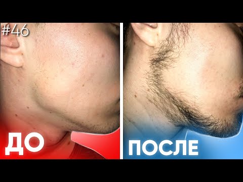 Видео: 3 месяца не мог пробить рост бороды. Результаты ксиноксина