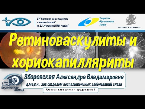 Видео: Ретиноваскулиты и хориокапилляриты