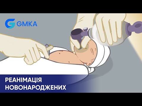 Видео: 5/6 Реанімація новонароджених: загрозливі ознаки і застосування носових катетерів