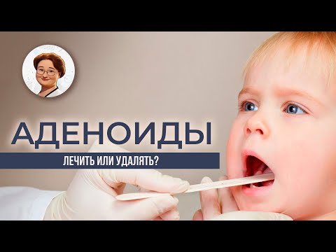 Видео: Аденоиды. Лечение, когда нужно удалять и как снизить риски осложнений.
