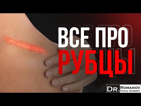 Видео: Гипертрофические рубцы — Игорь Романов, пластический и челюстно-лицевой хирург