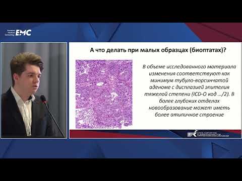 Видео: 5. Что должен и может описать патоморфолог в полипе толстой кишки — Мороз Глеб Александрович