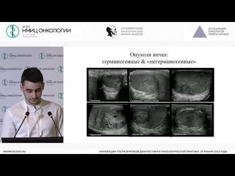 Видео: Роль мультипараметрического УЗИ в диагностике опухолей яичек