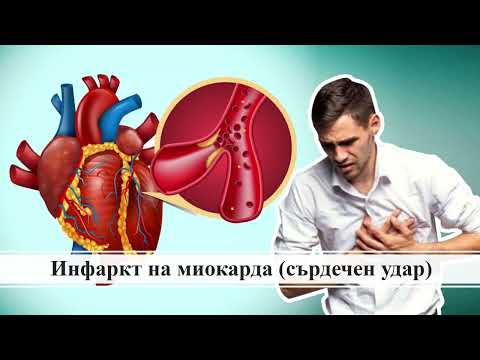 Видео: ТЕМА №50 - БОЛЕСТИ НА КРЪВОНОСНАТА СИСТЕМА ПРИ ЧОВЕКА