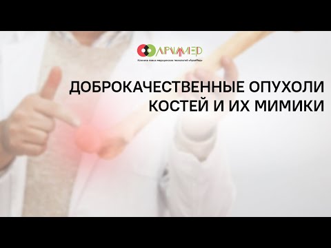 Видео: Доброкачественные опухоли костей и их мимики