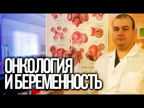 Видео: Онкология и беременность. К.м.н. Оводенко Дмитрий Леонидович. Москва.