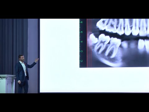 Видео: Конгресс ITI 2018, 12-13 октября, Сочи. Выступление Арслана Амирова.