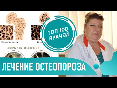 Видео: Лечение остеопороза: лекарство, препараты и таблетки. Как лечить остеопороз у женщин, профилактика