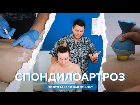 Видео: Боли в спине, о которых вы не знали! Или тайны спондилоартроза.