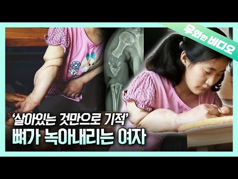 Видео: Чудесная женщина, которая не может чувствовать боль