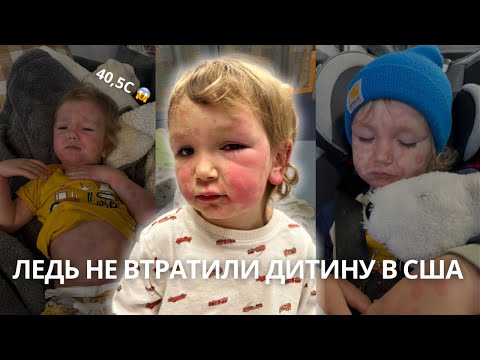 Видео: лікували зубну біль, а госпіталізовали з НАБРЯКОМ КВІНКЕ: в скільки це нам обійшлося 🫣