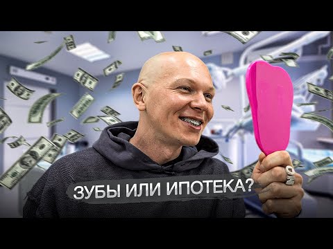 Видео: Установил брекеты | реалити-шоу Мама, я стилист | 2 Выпуск | Сезон 2 |