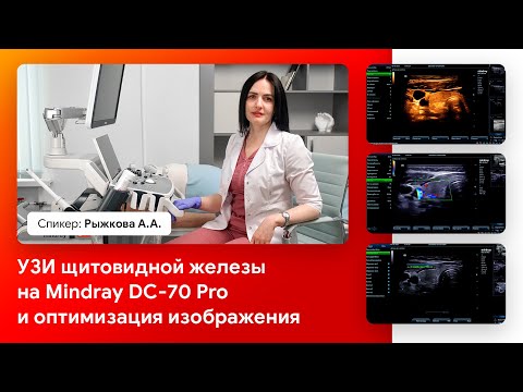 Видео: УЗИ щитовидной железы на Mindray DC-70 Pro и оптимизация изображения