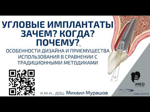 Видео: Вебинар "Угловые имплантаты - зачем когда почему"