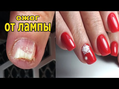 Видео: ❤ ШОК ❤ впервые ВИЖУ ❤ СОЖГЛА ноготь В ЛАМПЕ ❤РЕКОНСТРУКЦИЯ ногтя ❤ КРАСНЫЙ маникюр ❤ РЕМОНТ ногтя ❤