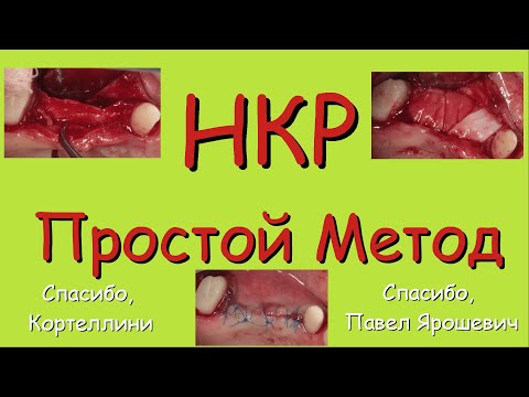 Видео: НКР. Простой метод