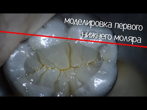 Видео: Моделировка Первый Нижний Моляр
