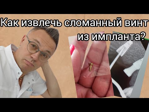 Видео: Сломал винт в импланте. Извлечение винта. 