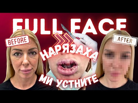 Видео: ЛИПСА НА ТЪКАН и УСЛОЖНЕНИЕ ПОД ОЧИТЕ - “ВЪЗВЪРНАХ МЛАДОТО СИ АЗ”/ПП с д-р Петкова Е03/