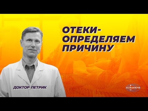 Видео: Отеки. Определяем причины