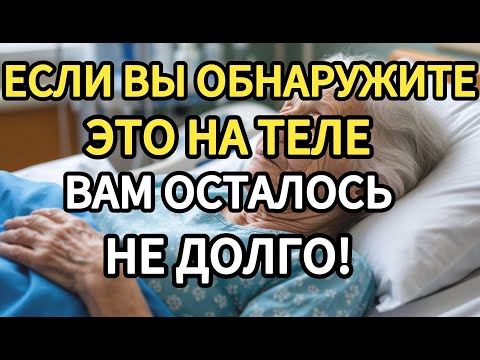 Видео: ЕСЛИ НА ТЕЛЕ ПОЖИЛОГО ЧЕЛОВЕКА ВДРУГ ПОЯВЛЯЕТСЯ ЭТО, ГОТОВЬТЕСЬ К ХУДШЕМУ…