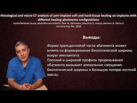 Видео: Мягкотканная интеграция имплантата (часть5). Субкрестальная установка имплантата.