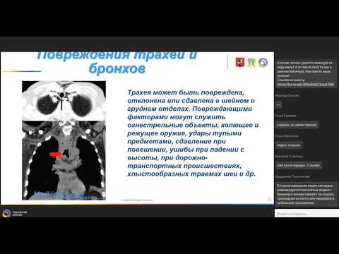 Видео: Лучевая диагностика легких при плановом обследовании и экстренных ситуациях