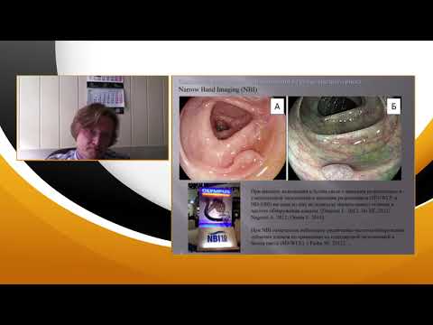 Видео: 3. Дуванский В.А. Современная эндоскопия в диагностике колоректальных неоплазий. Тренды.