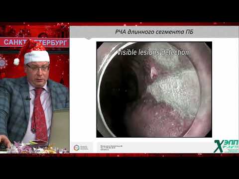 Видео: Разбор клинических случаев сложной диагностики и ведения пациентов с пищеводом Баррета. К. В. Шишин