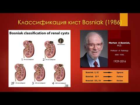 Видео: УЗ-диагностика кист почек за 7 минут. УЗИ в урологии-2020 (минисерии) Станислав Феданов