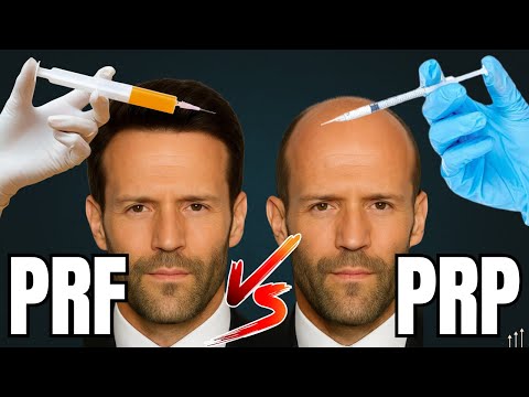 Видео: Лучше ли PRF, чем PRP при выпадении волос: 3 ключевых отличия, которые нужно знать, прежде чем пл...