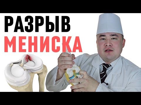 Видео: ТИЗЗА ИЧИ МЕНИСКИ ЁРИЛИШИ  "РАЗРЫВ МЕНИСКА" ХАҚИДА БАФУРЖА МАЪЛУМОТ, ДАВО ЧОРАЛАРИ