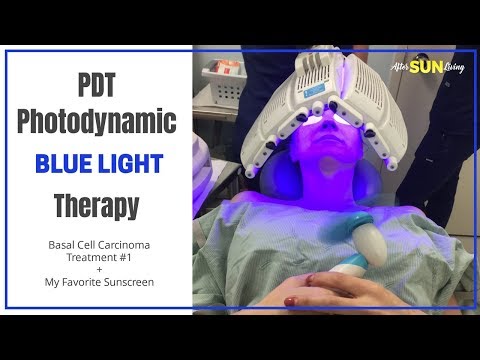 Видео: Фотодинамическая терапия синим светом (ФДТ) | Лечение рака кожи | Базальноклеточная карцинома | EP04