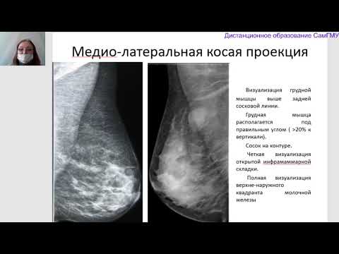 Видео: BI RADS  Лектор Колосова И Н