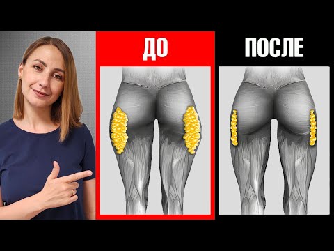 Видео: Быстро убираем ГАЛИФЕ! УШКИ на бёдрах уйдут. МФР тренировка ДОМА