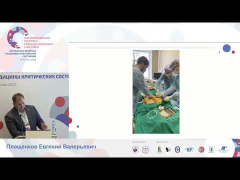 Видео: ВА ЭКМО канюляция и деканюляция сосудов Площенков Е.В.