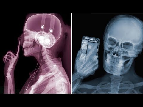 Видео: Удивительные вещи, которые можно увидеть только под рентгеном