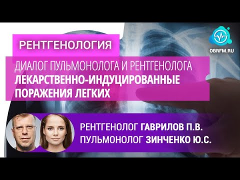 Видео: Гаврилов П.В., Зинченко Ю.С.: Диалог пульм-га и рент-га. Лекарств.-индуцированные поражения легких
