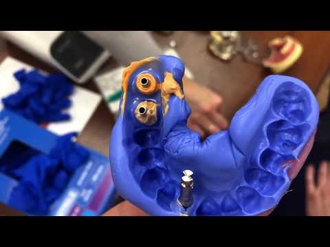 Видео: Снятие оттиска Осстем