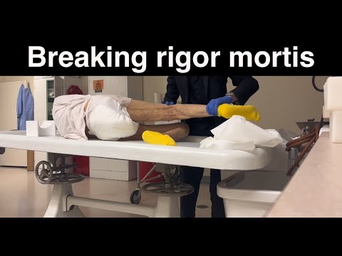 Видео: Преодоление трупного окоченения