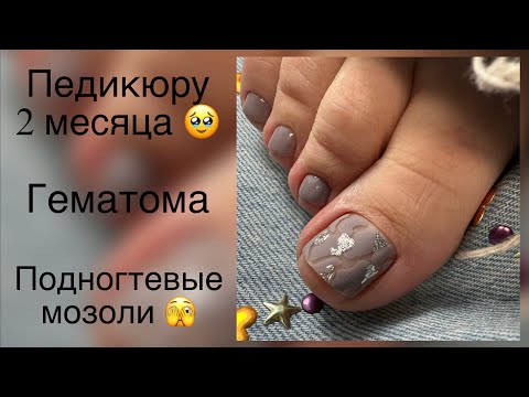 Видео: Чистый педикюр. Подногтевые мозоли 🧐 