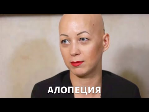 Видео: Диагноз "АЛОПЕЦИЯ": как справиться с потерей волос?