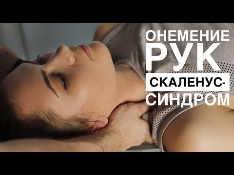 Видео: Онемение рук - скаленус синдром