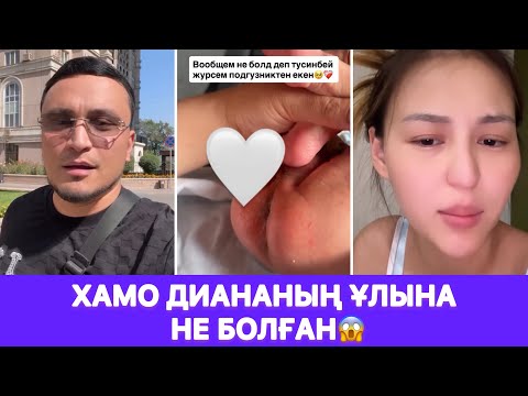 Видео: Хамо Диананың ұлына не болған😱